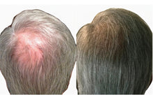 Load image into Gallery viewer, GROWTH PHASE MIN/RU: The Ultimate Hair Regrowth Solution for Minoxidil Users
